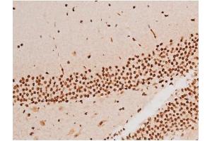 Immunohistochemistry (IHC) image for anti-Spleen tyrosine Kinase (SYK) (pTyr348) antibody (ABIN6255895)