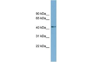 WB Suggested Anti-AMDHD1 Antibody Titration: 0. (AMDHD1 Antikörper  (N-Term))