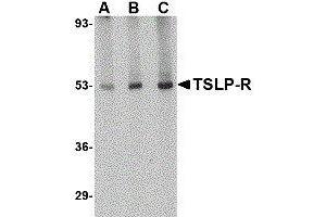 Western Blotting (WB) image for anti-Cytokine Receptor-Like Factor 2 (CRLF2) antibody (ABIN2476989)