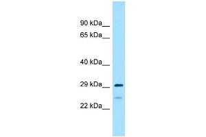 WB Suggested Anti-RPS4Y2 Antibody Titration: 1.