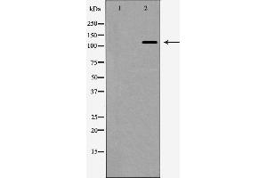 Western blot analysis of nNOS expression in HeLa cells,The lane on the left is treated with the antigen-specific peptide.