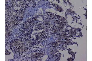 IHC analysis of NRF1 using anti-NRF1 antibody (ABIN6719347). (NRF1 Antikörper  (AA 246-503))