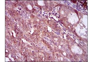 Immunohistochemistry (IHC) image for anti-EGFR Mutant (AA 693-893), (Mutant) antibody (ABIN1845729) (EGFR Mutant (AA 693-893), (Mutant) Antikörper)