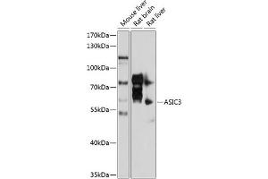 Western blot analysis of extracts of various cell lines, using  antibody (ABIN6129940, ABIN6137191, ABIN6137192 and ABIN6214455) at 1:1000 dilution. (ASIC3 Antikörper  (AA 62-320))