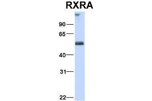 Host:  Rabbit  Target Name:  RXRA  Sample Type:  Human Fetal Heart  Antibody Dilution:  1.