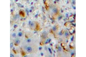 Used in DAB staining on fromalin fixed paraffin-embedded Liver tissue (Fc gamma RII (CD32) (AA 47-285) Antikörper)