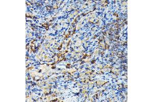 Immunohistochemistry of paraffin-embedded mouse spleen using PRC1 Rabbit pAb (ABIN6128502, ABIN6146124, ABIN6146125 and ABIN6222808) at dilution of 1:100 (40x lens). (PRC1 Antikörper  (AA 351-620))
