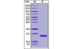 SDS-PAGE (SDS) image for Complement Component 5a (C5a) (AA 679-755) (Active) protein (His tag) (ABIN6809899)