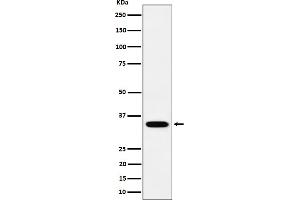 Western blot analysis of PPCS expression in SH-SY5Y cell lysate.