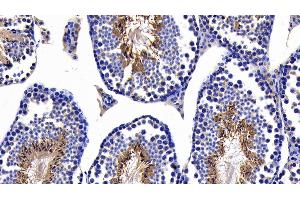 Detection of CASP8 in Mouse Testis Tissue using Polyclonal Antibody to Caspase 8 (CASP8) (Caspase 8 Antikörper  (AA 219-376))