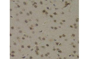 Immunohistochemistry of paraffin-embedded Mouse brain using PAWR Polyclonal Antibody at dilution of 1:200 (40x lens). (PAWR Antikörper)