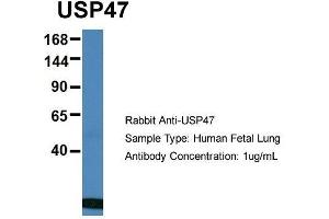 Host: Rabbit  Target Name: USP47  Sample Tissue: Human Fetal Lung  Antibody Dilution: 1. (USP47 Antikörper  (Middle Region))