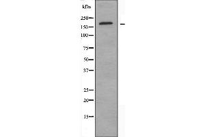 Western blot analysis of extracts from Jurkat cells, using MED1 antibody. (MED1 Antikörper  (C-Term))