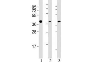 Western blot testing of ERCC1 antibody at 1:2000 dilution. (ERCC1 Antikörper  (AA 268-297))