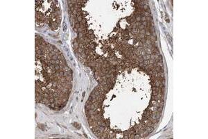 Immunohistochemical staining of human testis with POL3S polyclonal antibody  shows strong cytoplasmic positivity in cells of seminiferus ducts at 1:500-1:1000 dilution.