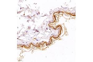 Immunohistochemistry of paraffin embedded mouse skin using TR2IT1 (ABIN7075887) at dilution of 1:1500 (400x lens) (TXNRD3NB Antikörper)