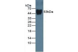 Detection of DBP in Rat Serum using Monoclonal Antibody to Vitamin D Binding Protein (DBP) (Vitamin D-Binding Protein Antikörper  (AA 209-394))
