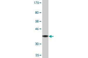 Western Blot detection against Immunogen (36. (IFT122 Antikörper  (AA 1194-1291))