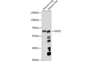 Western blot analysis of extracts of various cell lines, using SNTB1 antibody (ABIN7270693) at 1:1000 dilution.