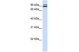 PCSK6 antibody used at 0. (PCSK6 Antikörper  (N-Term))