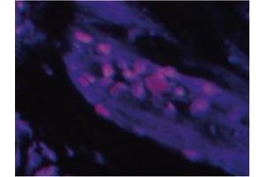 Immunofluorescence image ofTlP 39 staining in paraffn section of human trachea. (Parathyroid Hormone 2 (PTH2) Antikörper)