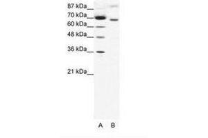 Image no. 1 for anti-Rac GTPase Activating Protein 1 (RACGAP1) (AA 20-69) antibody (ABIN202842) (RACGAP1 Antikörper  (AA 20-69))