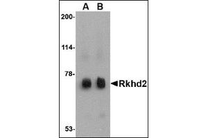 Western blot analysis of Rkhd2 in rat heart tissue lysate with this product at (A) 0. (MEX3C Antikörper  (C-Term))