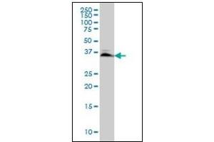 Western Blotting (WB) image for anti-SMAD, Mothers Against DPP Homolog 3 (SMAD3) antibody (ABIN781908) (SMAD3 Antikörper)