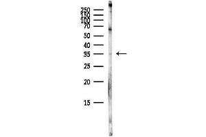 anti-Lymphocyte-Specific Protein 1 (LSP1) (C-Term) antibody