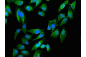 Immunofluorescent analysis of Hela cells using ABIN7150926 at dilution of 1:100 and Alexa Fluor 488-congugated AffiniPure Goat Anti-Rabbit IgG(H+L) (Dystonin Antikörper  (AA 1-195))