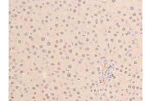 ABIN6267288 at 1/100 staining mouse liver tissue sections by IHC-P. (p53 Antikörper  (pSer392))