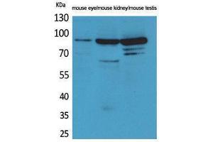 Western Blotting (WB) image for anti-HRS (HRS) (Internal Region) antibody (ABIN3180991) (HRS (HRS) (Internal Region) Antikörper)