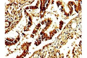 IHC image of ABIN7142886 diluted at 1:250 and staining in paraffin-embedded human lung tissue performed on a Leica BondTM system. (ADAMTS4 Antikörper  (AA 213-319))