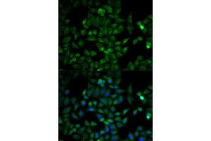 Immunofluorescence analysis of HeLa cells using TPI1 antibody. (TPI1 Antikörper)