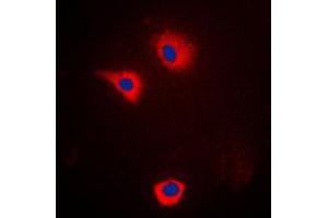 Immunofluorescent analysis of Cytochrome P450 2U1 staining in LOVO cells.