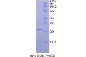 SDS-PAGE analysis of Mouse alpha Fodrin Protein. (SPTAN1 Protein)