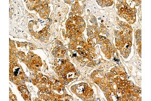 anti-Pericentrin (PCNT) (C-Term) antibody