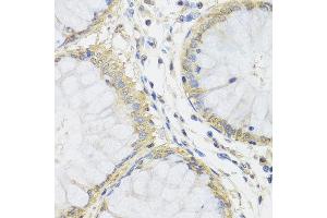 Immunohistochemistry of paraffin-embedded human colon using MTX1 antibody at dilution of 1:100 (x40 lens). (Metaxin 1 Antikörper)