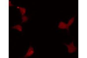 ABIN6272240 staining LOVO by IF/ICC. (MYBL1 Antikörper  (Internal Region))