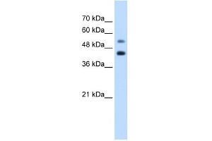 GTPBP2 antibody used at 1.