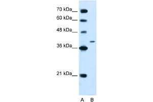 WB Suggested Anti-PTPN2 Antibody Titration:  2. (PTPN2 Antikörper  (N-Term))