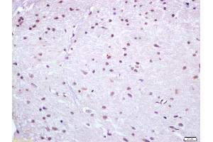 Formalin-fixed and paraffin embedded rat brain labeled with Anti Nur77 Polyclonal Antibody (ABIN747443), Unconjugated at 1:200, followed by conjugation to the secondary antibody and DAB staining (NR4A1 Antikörper  (AA 351-450))