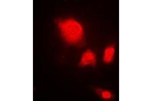 Immunofluorescent analysis of UCH-L5 staining in A549 cells. (UCHL5 Antikörper)