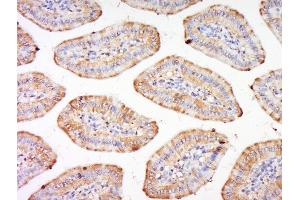 Paraformaldehyde-fixed, paraffin embedded mouse intestine, Antigen retrieval by boiling in sodium citrate buffer (pH6) for 15min, Block endogenous peroxidase by 3% hydrogen peroxide for 30 minutes, Blocking buffer (normal goat serum) at 37°C for 20min, Antibody incubation with Integrin alpha 3 Polyclonal Antibody, Unconjugated  at 1:200 overnight at 4°C, followed by a conjugated secondary and DAB staining. (ITGA3 Antikörper  (AA 976-1025))