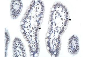 HNRPA1 antibody was used for immunohistochemistry at a concentration of 4-8 ug/ml to stain Epithelial cells of intestinal villus (arrows) in Human Intestine . (HNRNPA1 Antikörper  (C-Term))
