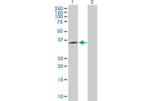 Western Blot analysis of BDKRB1 expression in transfected 293T cell line by BDKRB1 MaxPab polyclonal antibody. (BDKRB1 Antikörper  (AA 1-353))