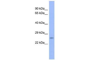 PSMB6 antibody used at 1 ug/ml to detect target protein.