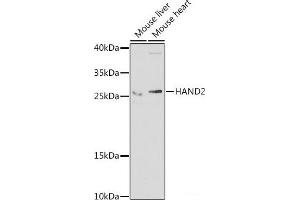 Western blot analysis of extracts of various cell lines using HAND2 Polyclonal Antibody at dilution of 1:1000. (HAND2 Antikörper)