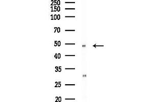 anti-Histone Acetyltransferase 1 (HAT1) (C-Term) antibody