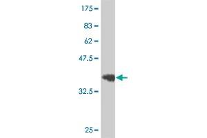 Western Blot detection against Immunogen (36. (EPH Receptor B3 Antikörper  (AA 899-997))